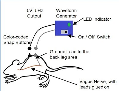 Vagal Nerve Stimulator